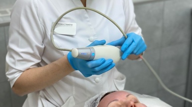 Лазерная шлифовка лица