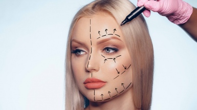 Контурная пластика