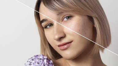 Глубокая чистка лица