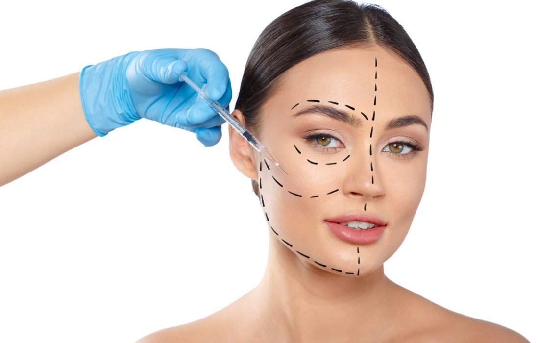 Нитевой лифтинг Aptos для подтяжки лица