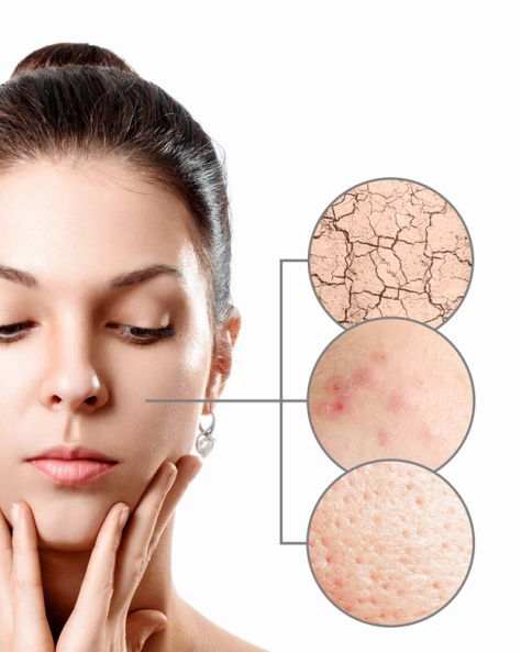 Как убрать сосудистую сетку на лице