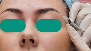 Биоармирование