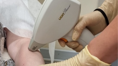 Удаление волос с помощью лазерной эпиляции