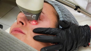 Лазерное удаление рубцов и шрамов