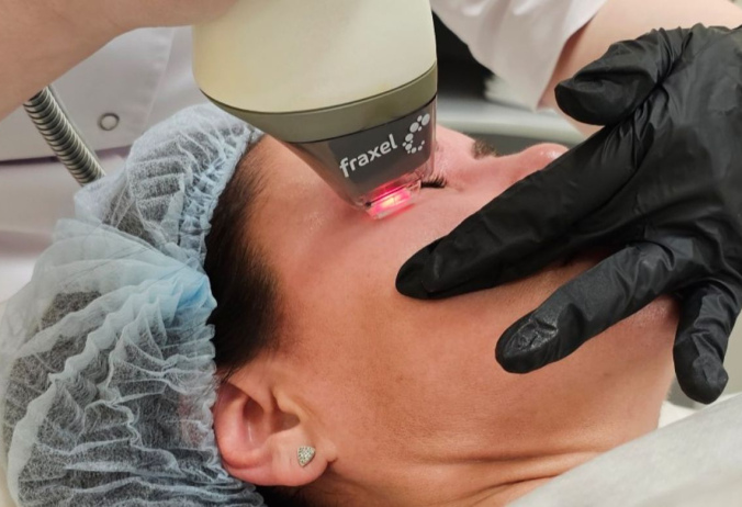 Fraxel re:store