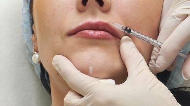 Контурная пластика