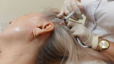 Лечение выпадения волос