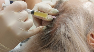 Консультация врача-трихолога