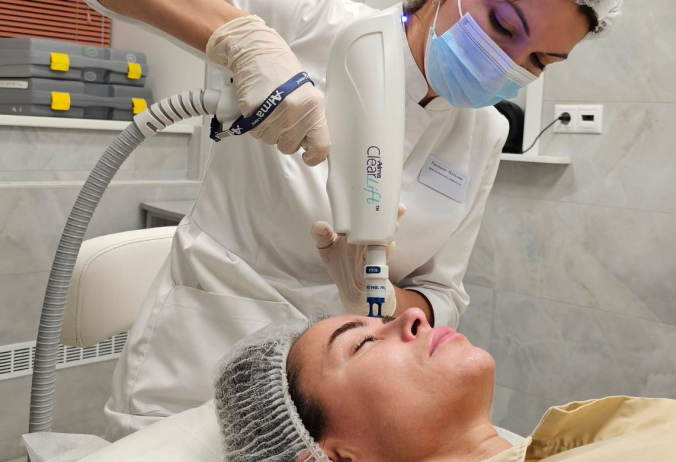 Клиарлифт Хармони / Clear Lift Harmony