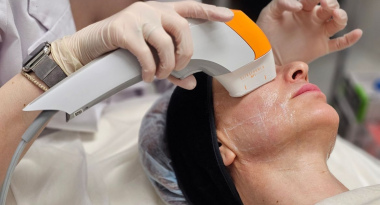 Чёткий овал и менее выраженные грыжи с косметологом Мартиросян Стеллой