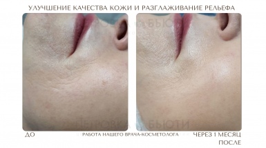 Качество кожи