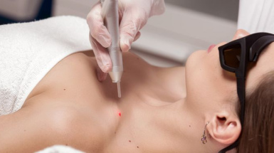 Удаление мелких новообразований